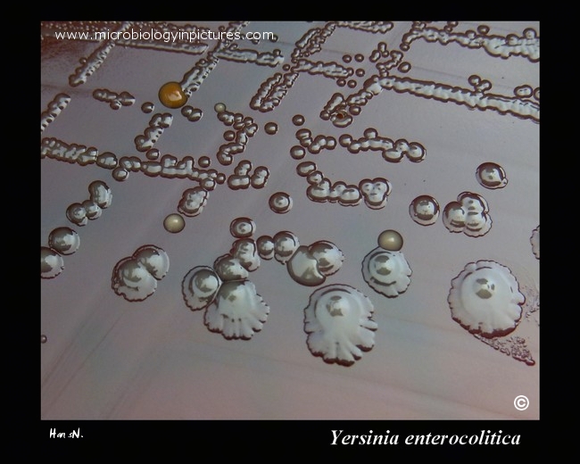 Yersinia on blood agar, prolonged cultivation